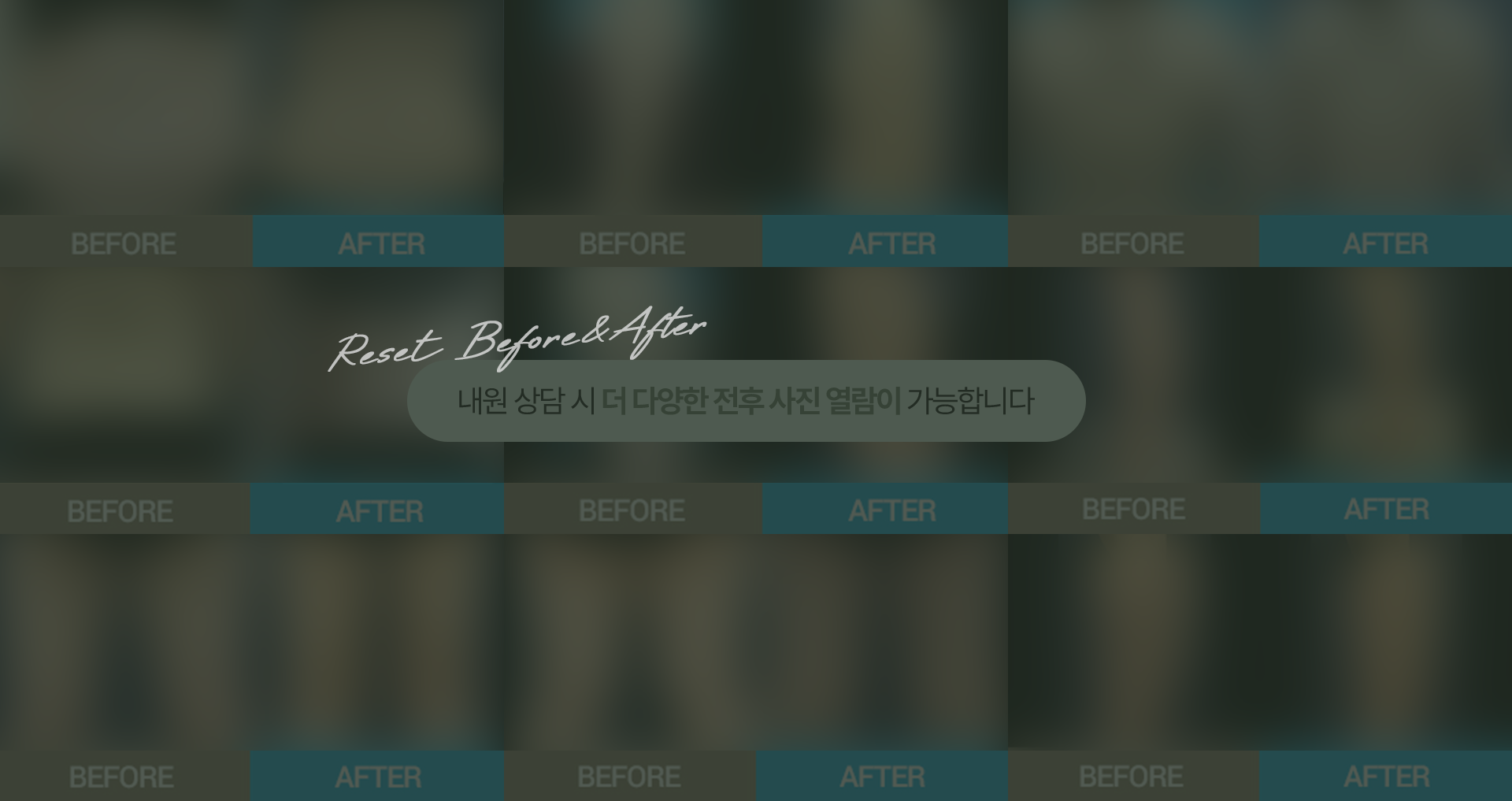 전후사진